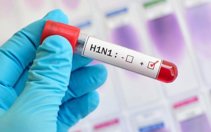 الصحة: انفلونزا H1N1 موسمية ولا خطر منها