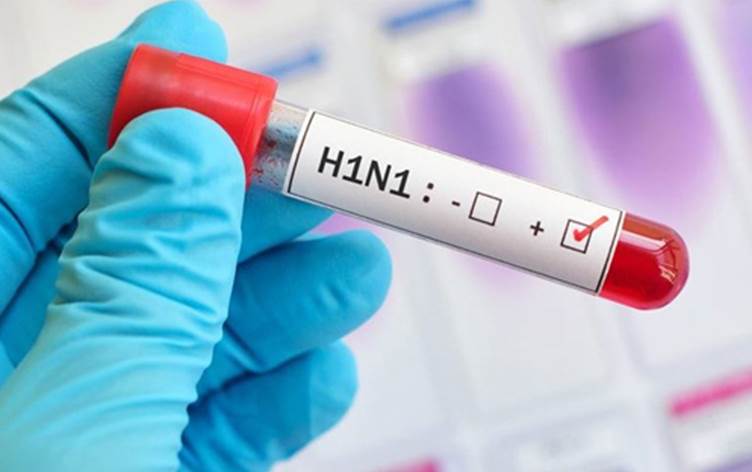 الصحة تنفي وفاة 4 اشخاص من اسرة واحدة بانفلونزا الخنازير في الزرقاء
