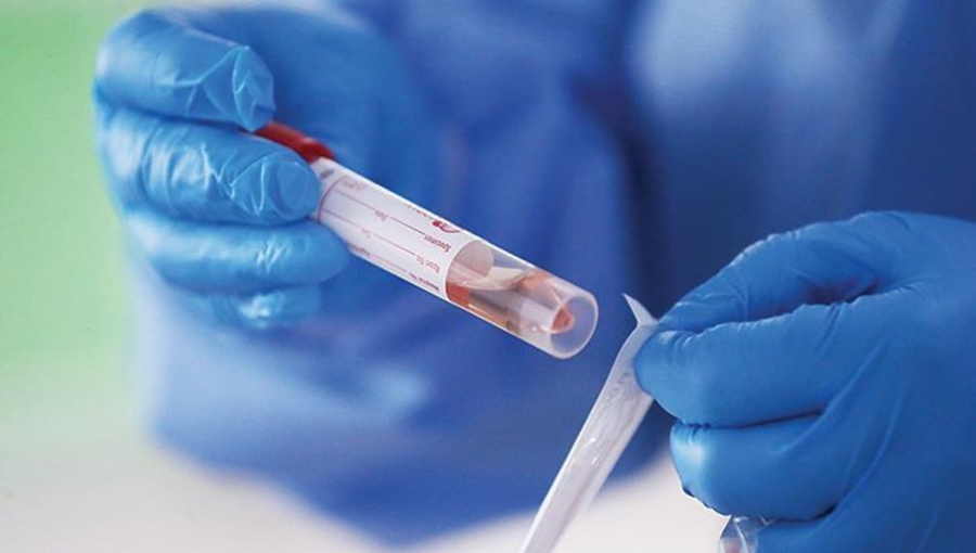 الصحة: تسجيل 3 إصابات جديدة بفيروس كورونا في الاردن جميعها «غير محلية»